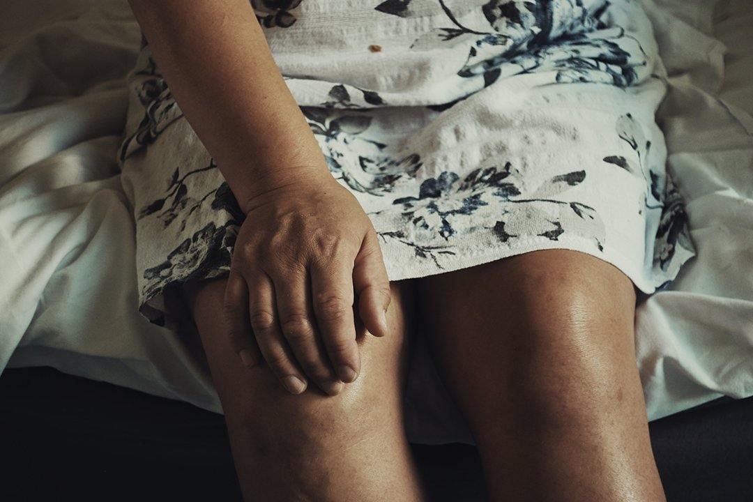 Combatting Osteoarthritis with Hemp Seeds! - 13 Seeds Hemp Farm