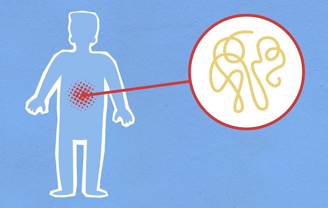 Can Hemp Seed Oil be effective for inflammatory bowel disease? - 13 Seeds Hemp Farm