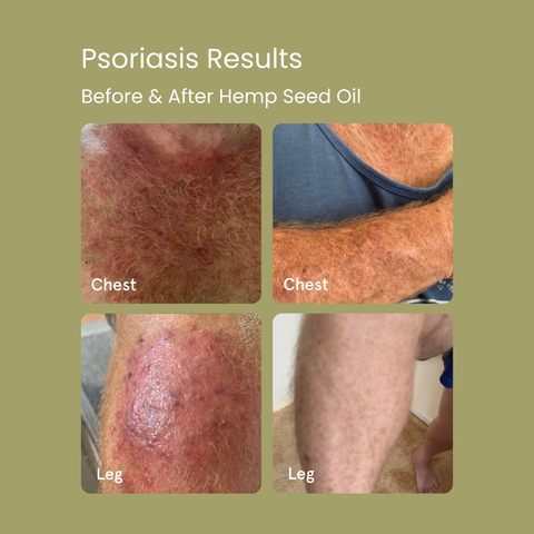 Dry Skin Pack
