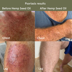 Hempseed Oil Capsules