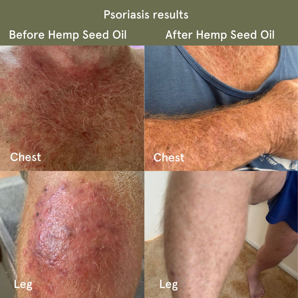 Hempseed Oil Capsules